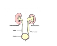Akut Böbrek Yetmezliği Belirtileri ve Tedavisi